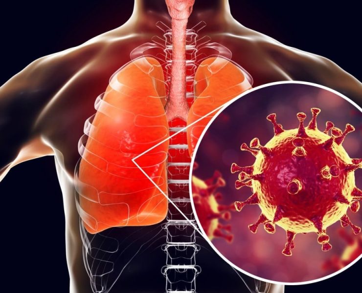 ¿Qué es el HMVP? Nuevo virus que está azotando a China