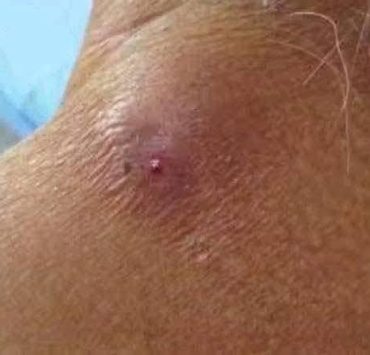 Gusano barranador